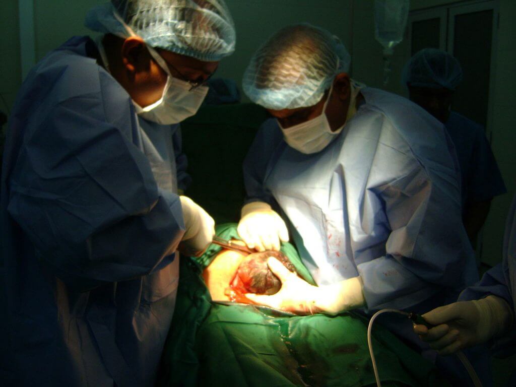 what-is-a-caesarian-section