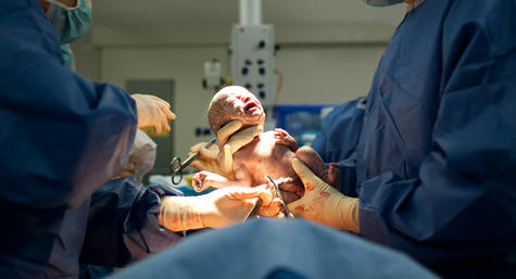 Caesarean 