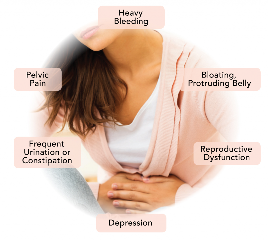 Fibroids-Symptoms