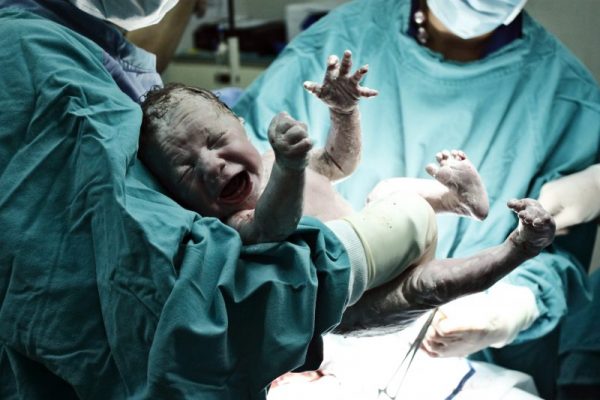 Preterm labour-pregnancy