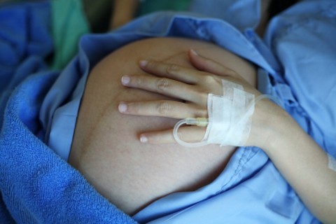cesarean