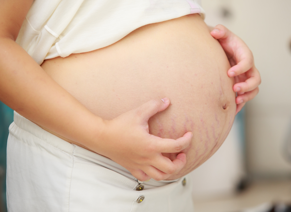 itching-during-pregnancy-cholestasis