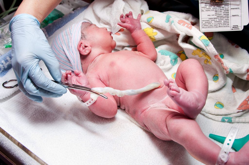 umbilical-cord-prolapse-baby-kidborn