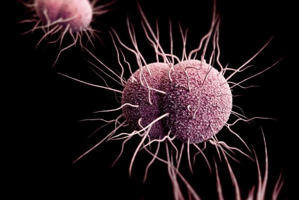 gonorrhea-during-pregnancy